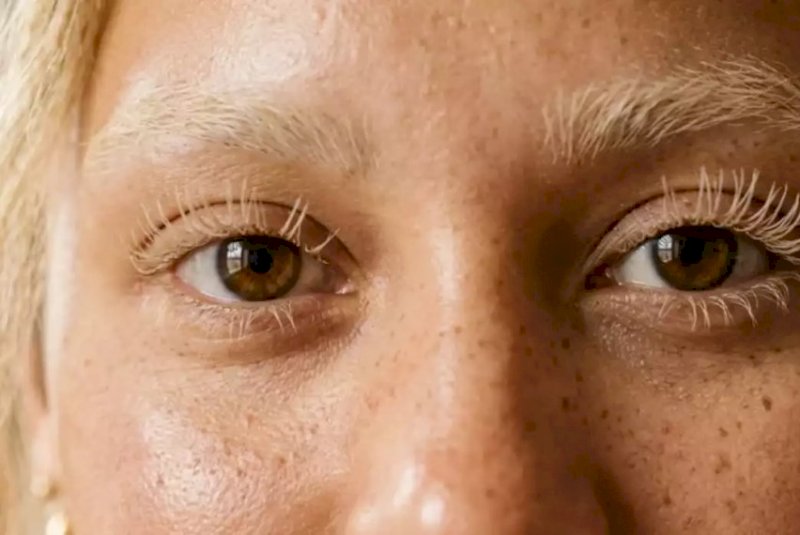 Você sabia que descolorir cílios pode perfurar os olhos?