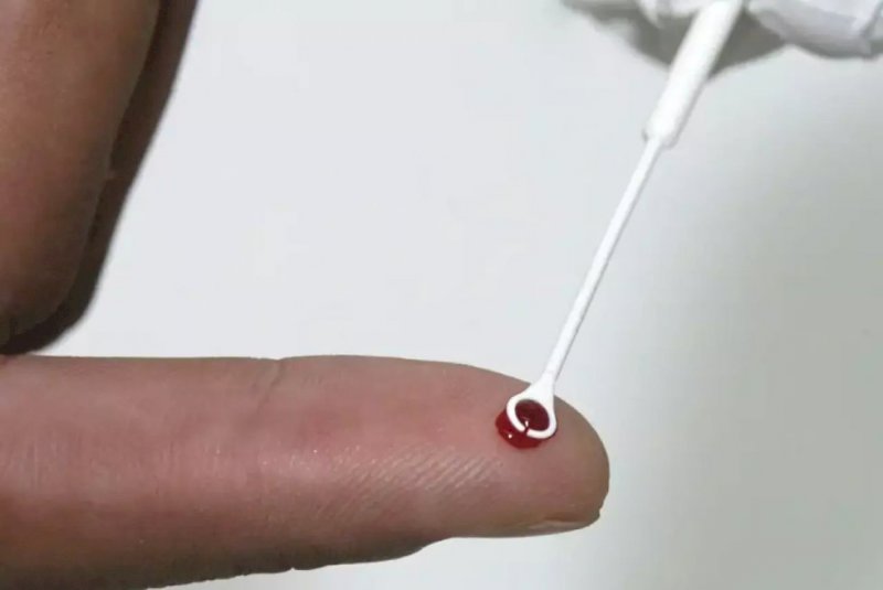 Fiji declara emergência nacional por HIV com 1 caso a cada 60 pessoas