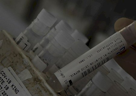 Covid-19: bebês de até 1 ano representam um terço das mortes infantis