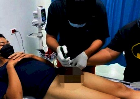 Pênis fica entalado em cano após jovem fazer procedimento para aumentar o órgão