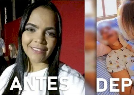 'Recuperação é lenta', diz tia de professora em estado vegetativo após contrair Covid-19