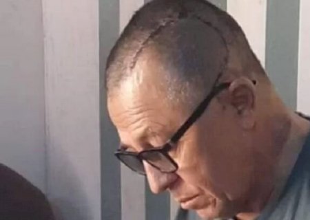 Com mesma doença de Bruce Willis, cantor faz apelo para tratar afasia em Maracaju
