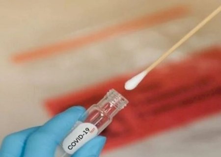 Mulher de Dourados está entre as sete vítimas da Covid em MS 