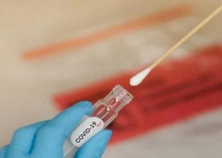 Duas mulheres morrem por Covid em semana com mais de 400 testes positivos