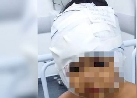 Criança atacada por Pitbull em Ribas recebe alta após ficar uma semana internada