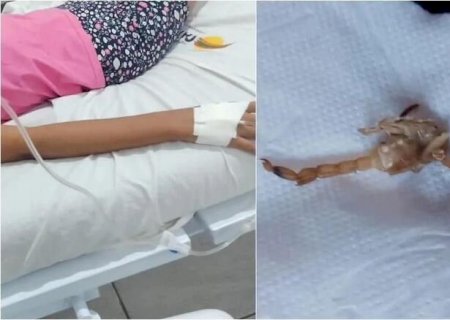 Picada por escorpião em Ribas, criança de 3 anos está em estado grave na Santa Casa
