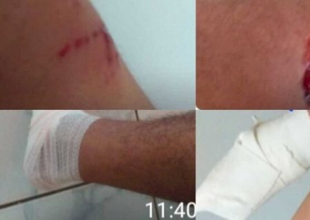 Homem e dois cachorros são atacados por teiú em Glória de Dourados