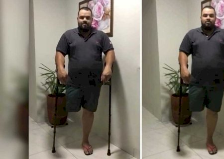Morador de Sidrolândia perde perna por picada de cobra e pede ajuda para prótese (vídeo)