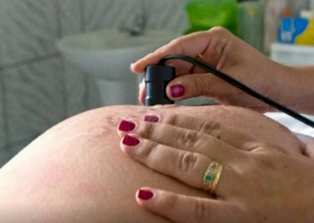 Saúde recomenda cálcio para todas as gestantes para prevenir eclâmpsia