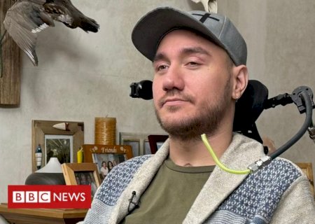 O homem que serve de 'cobaia' para chip de Elon Musk no cérebro para controlar computador com pensamento
