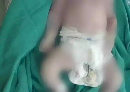Hospitais em MS v&atilde;o adotar "check-list" para evitar mortes durante partos