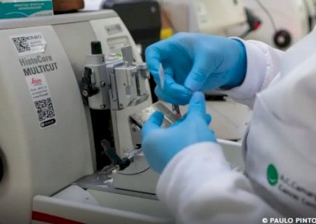 Cura de câncer de próstata pode chegar a até 98%