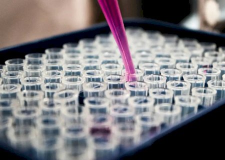 Inflamação no cérebro pode ser chave para avanço do Alzheimer, diz estudo brasileiro