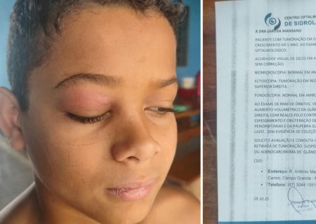 Em Sidrolândia, mãe pede ajuda para custear cirurgia e retirar tumor no olho do filho de 11 anos