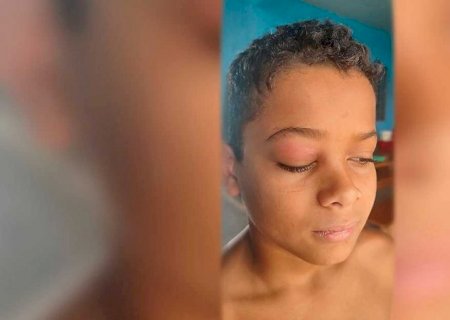 Sidrolândia - UPA trata dor no olho como toxoplasmose, mas era tumor; criança precisa de cirurgia urgente