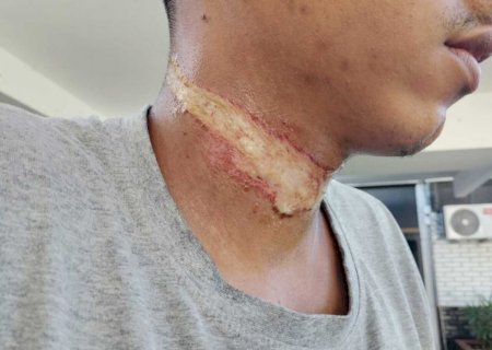 Corda 'atravessada' em rua derruba motociclista e por pouco não causa tragédia