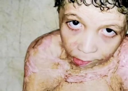 Após 33 dias em coma, sonho de Wellynyon é voltar a estudar e ter vida 'normal'