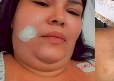 'Pior dor do mundo'! Mulher com Neuralgia do Trigêmeo pede ajuda para continuar tratamento