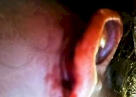 Suspeito de estuprar beb&ecirc; foi indiciado por espancar e provocar aborto na ex