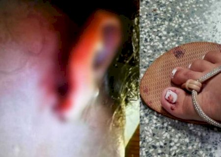 Suspeito de estuprar bebê provocou aborto na mãe da criança; menina está em estado grave