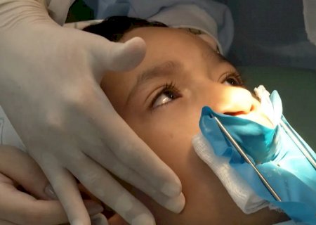 Fissura labiopalatina demanda tratamento precoce e multidisciplinar