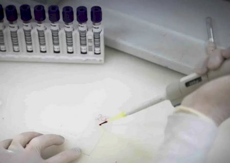 Secretaria de Saúde de SP investiga novo caso suspeito de ebola