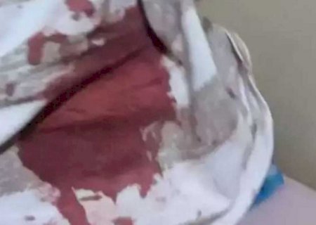 Criança vê mãe ensanguentada após agressão e pede socorro a vizinhos em Dourados