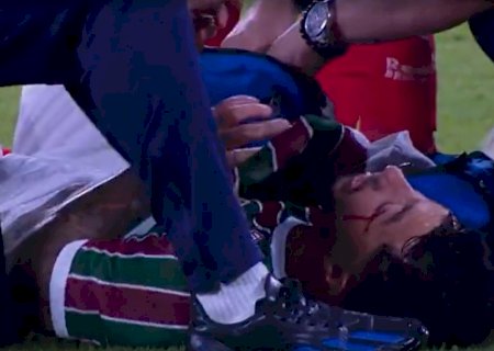 Fluminense x Bragantino: Lucho Acosta fica sangrando após cotovelada de Agustín Sant'Anna