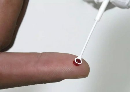 Fiji declara emergência nacional por HIV com 1 caso a cada 60 pessoas