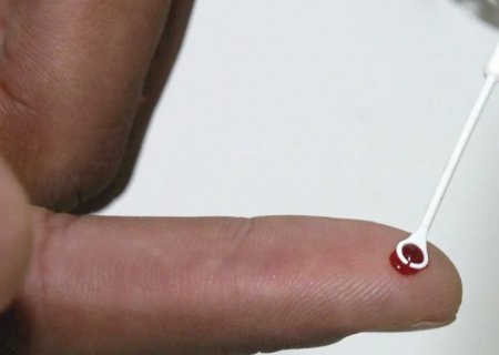 Fiji declara emergência nacional por HIV com 1 caso a cada 60 pessoas